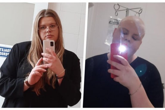 Wiktoria. Zdjęcia z serwisu Siepomaga.pl